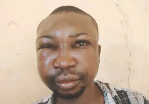 Federal lawmaker condemns attack on former councillor, others, in his constituency