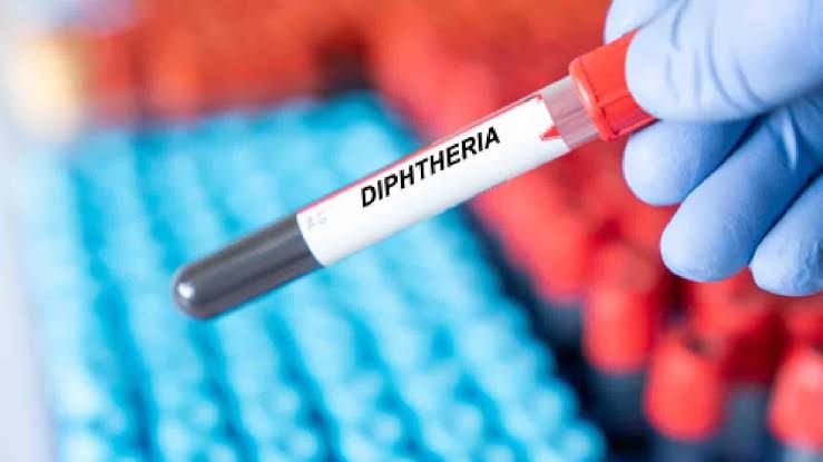 Kaduna records 20 diphtheria deaths, 156 confirmed cases